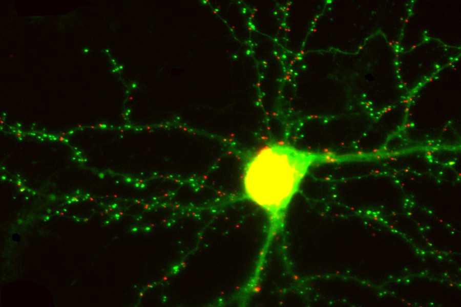Neuron
