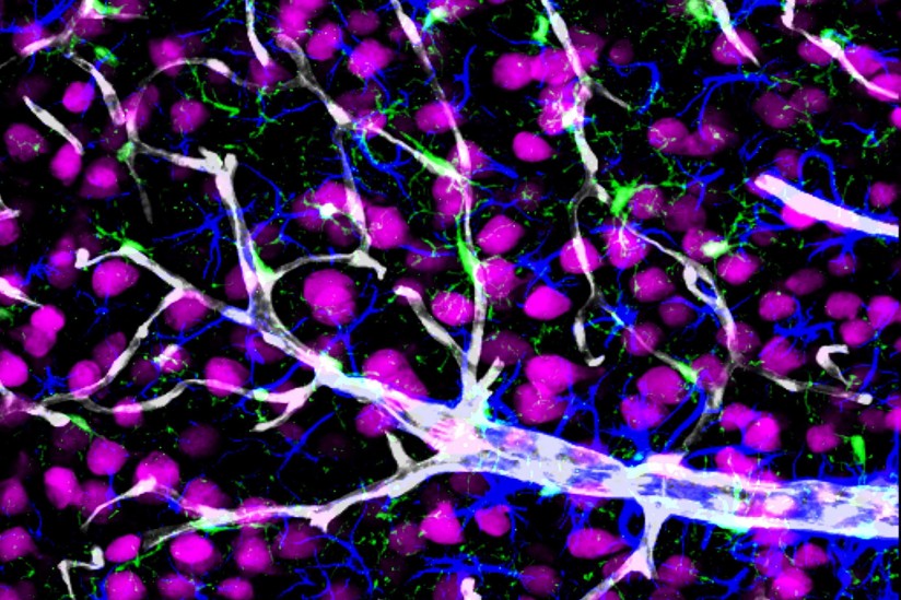 Brain, Blood vessels,