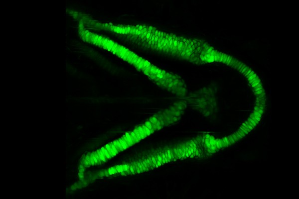 a gene called Sox9 (green) in cartilage-producing cells