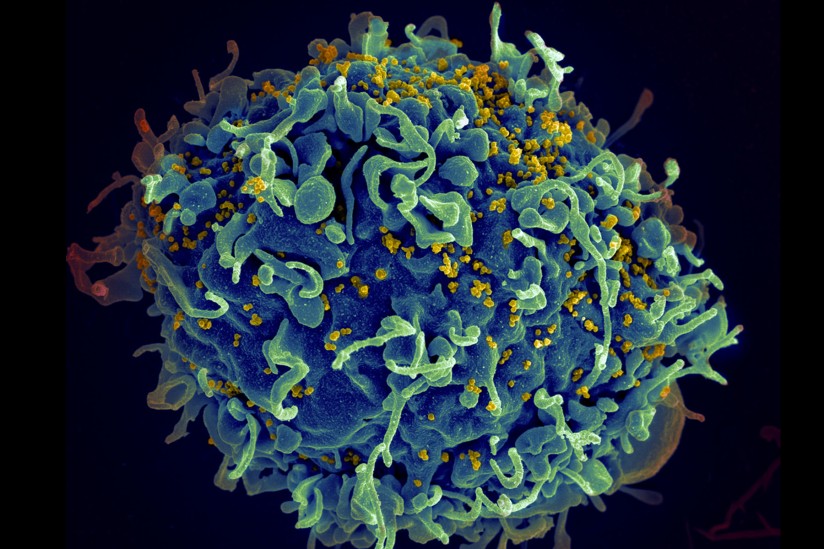 T cell under attack by HIV