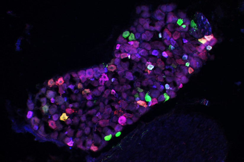 Sensory neuron photomicrograph