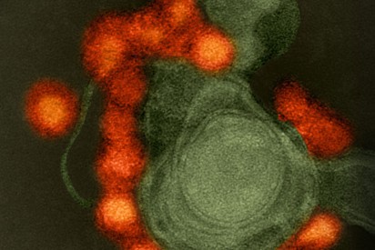 Zika virus