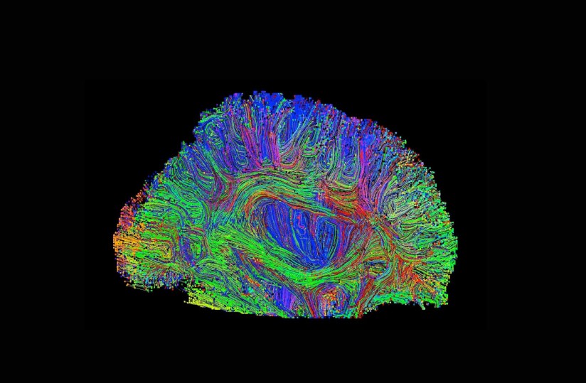 brain image
