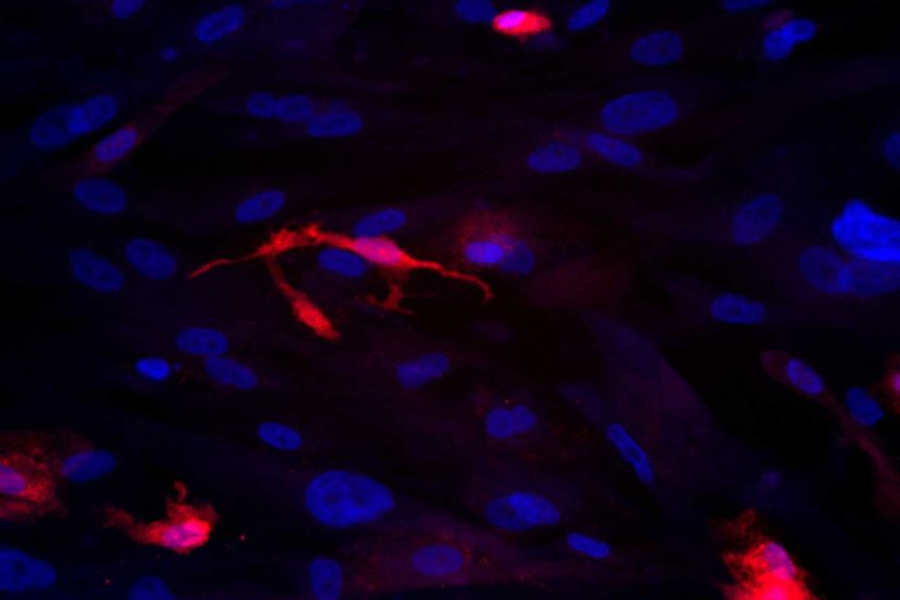 Microglia cells