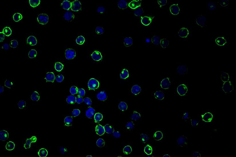 Cell microscopy showing HIV target cells with the Delta 20 protein expressed.
