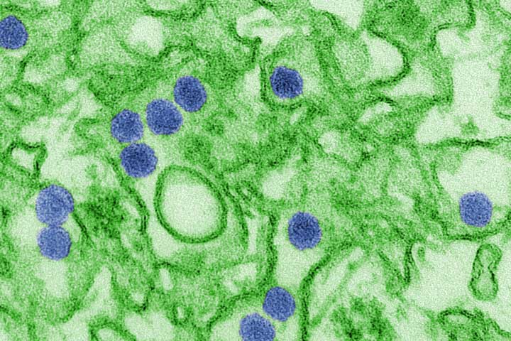 Zika virus image