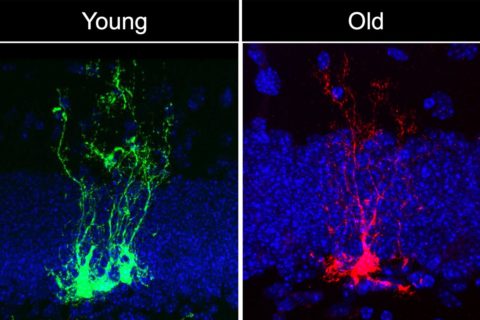 Neural stem cell clones