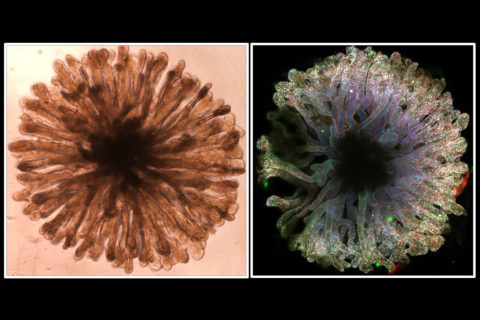 synthetic kidney organoid