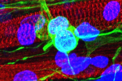 Neurons and muscle
